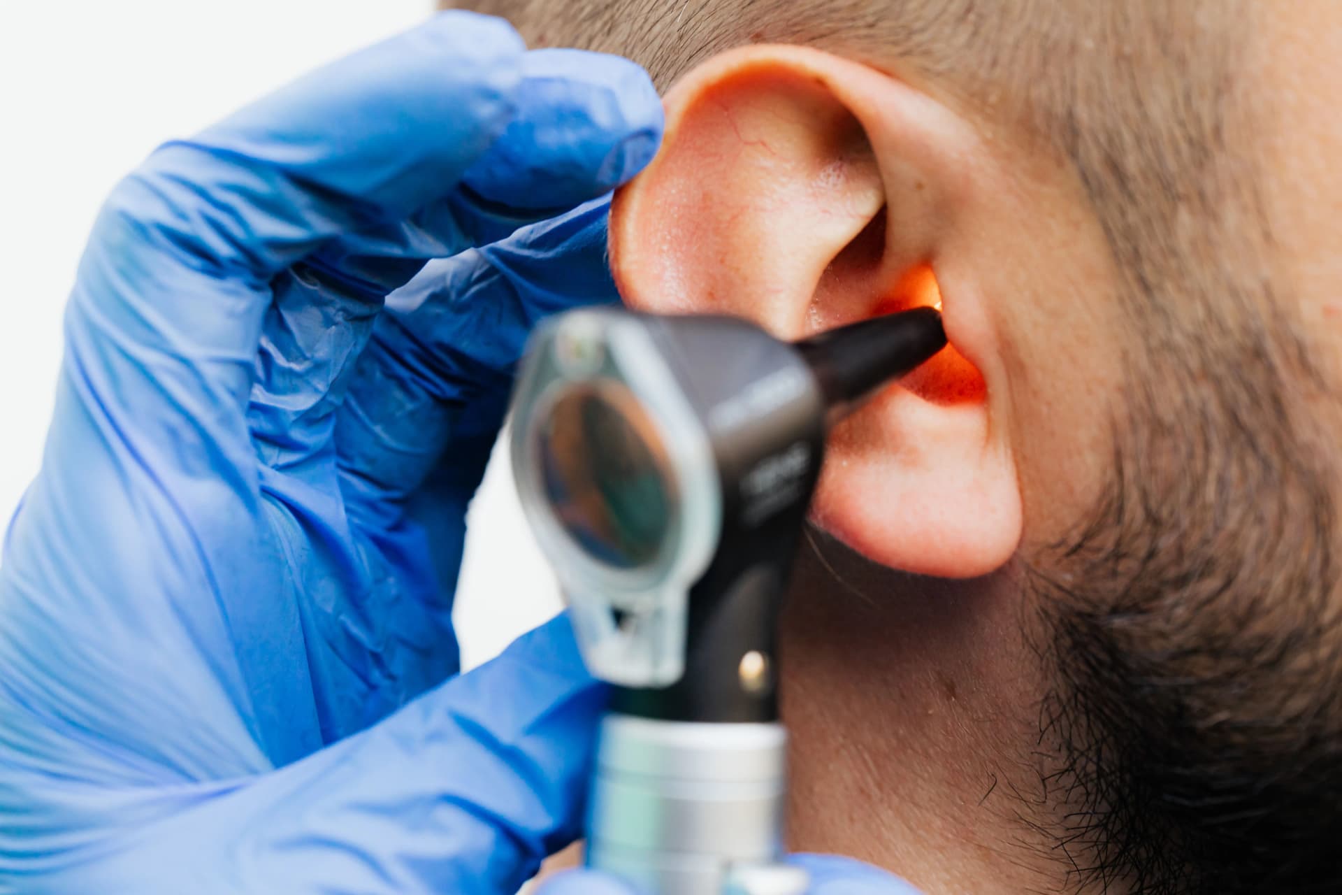 Timpanoplastia en Puerto Vallarta