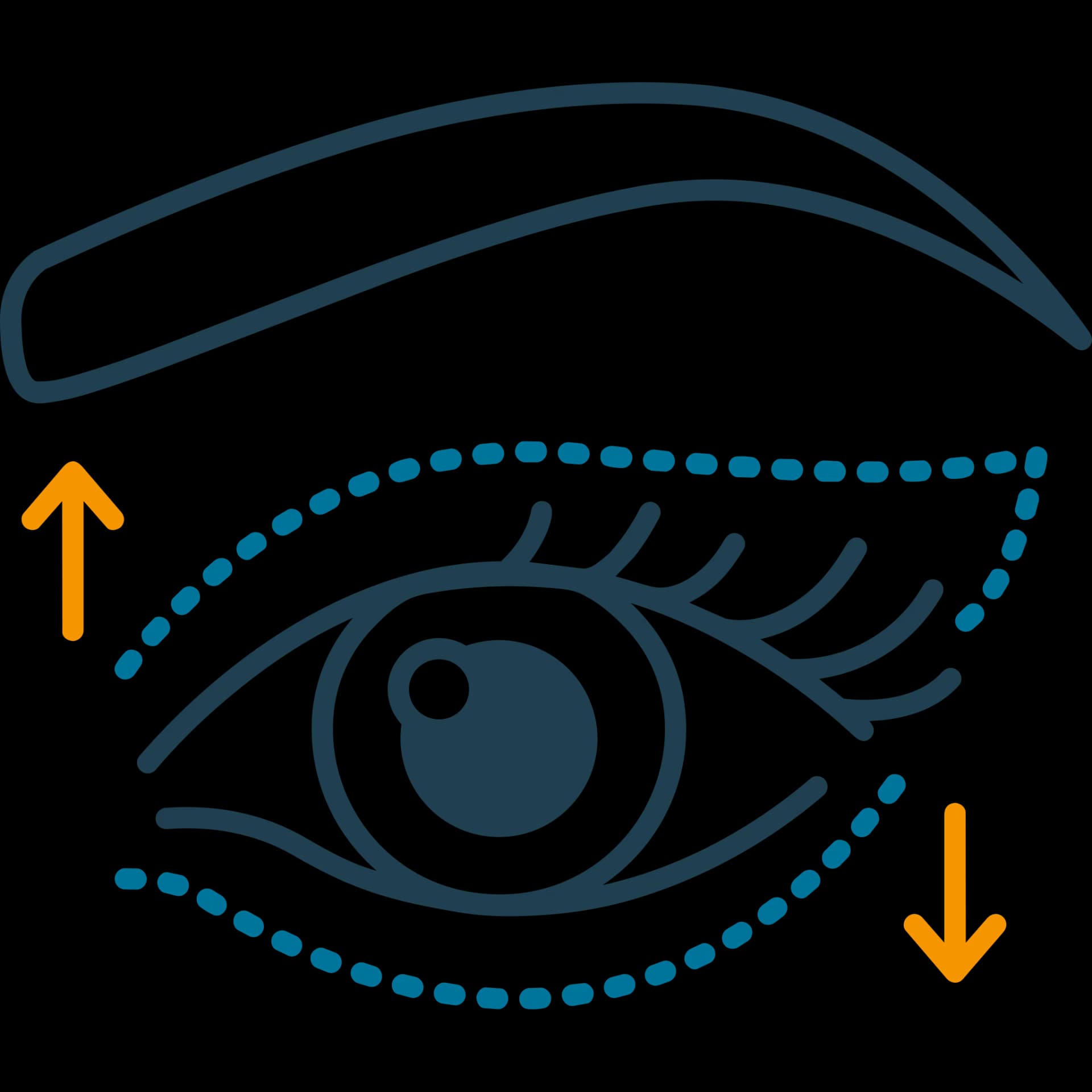 Ilustración de Blefaroplastia — Healthcare by the Sea, Puerto Vallarta