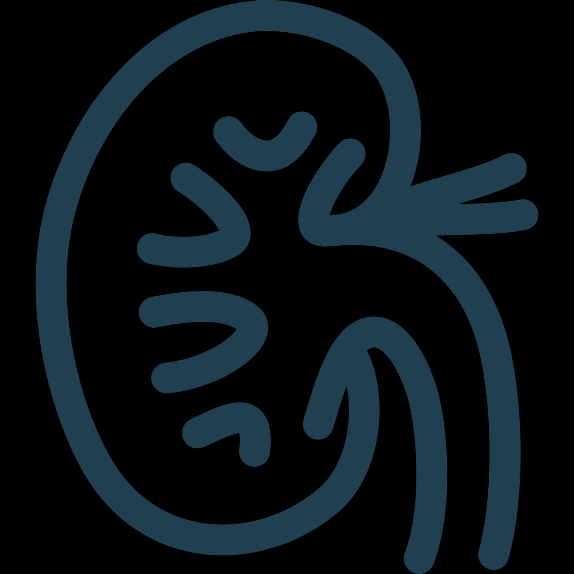 Ilustración de Cirugía de piedras del riñón — Healthcare by the Sea, Puerto Vallarta
