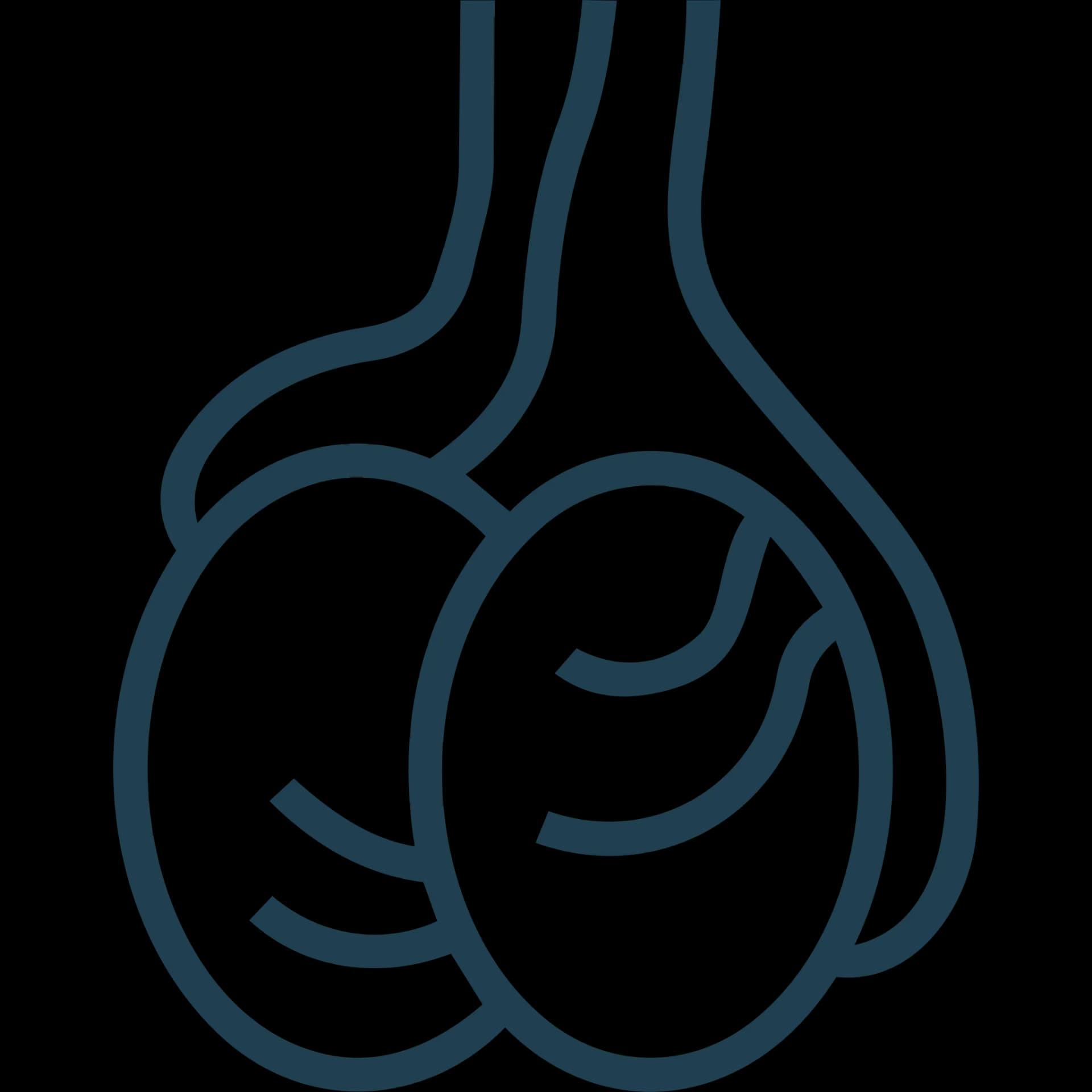 Ilustración de Varicocelectomía — Healthcare by the Sea, Puerto Vallarta