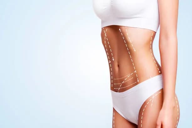 Liposucción en Puerto Vallarta